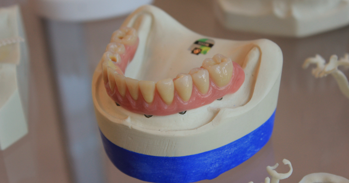 vragen Aangepaste Gewoon doen Veel patiënten met gebitsprothese onnodig verzekerd voor tandartskosten' |  CTI Warmond