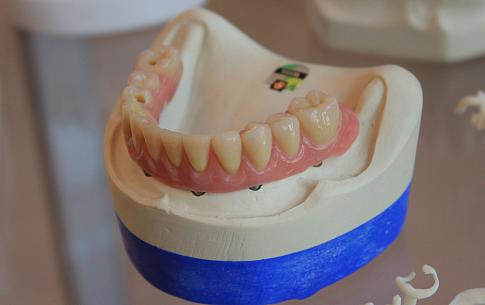 'Veel patiënten met gebitsprothese onnodig verzekerd voor tandartskosten'